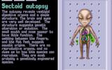 Sectoid-autopsy